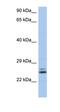 RAB15, Member RAS Oncogene Family antibody, orb326052, Biorbyt, Western Blot image 