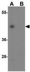 NP2 antibody, GTX31338, GeneTex, Western Blot image 