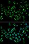 Cyclin Dependent Kinase Inhibitor 3 antibody, LS-C331864, Lifespan Biosciences, Immunofluorescence image 