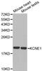 Potassium voltage-gated channel subfamily E member 1 antibody, A01229, Boster Biological Technology, Western Blot image 