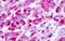 Lysophosphatidic Acid Receptor 5 antibody, GTX71499, GeneTex, Immunohistochemistry paraffin image 