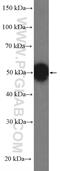 Actin Like 6B antibody, 27215-1-AP, Proteintech Group, Western Blot image 