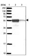Chromosome transmission fidelity protein 8 homolog antibody, PA5-62507, Invitrogen Antibodies, Western Blot image 
