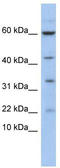 LIM Domain Only 2 antibody, TA330149, Origene, Western Blot image 