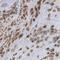 Protein FAM110B antibody, HPA011781, Atlas Antibodies, Immunohistochemistry frozen image 