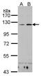 CD11C antibody, GTX102519, GeneTex, Western Blot image 