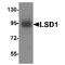 Lysine Demethylase 1A antibody, TA349187, Origene, Western Blot image 