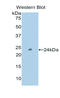 Peroxidasin antibody, LS-C295809, Lifespan Biosciences, Western Blot image 