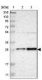 Tetraspanin 13 antibody, PA5-52434, Invitrogen Antibodies, Western Blot image 
