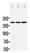 GRIN2B antibody, PA1059-1, Boster Biological Technology, Western Blot image 