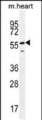 Smoothelin Like 2 antibody, PA5-48261, Invitrogen Antibodies, Western Blot image 