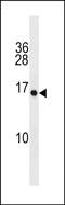 Plasminogen-related protein A antibody, PA5-49130, Invitrogen Antibodies, Western Blot image 