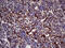 Killer Cell Lectin Like Receptor B1 antibody, M03917-2, Boster Biological Technology, Immunohistochemistry paraffin image 