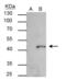 SET and MYND domain-containing protein 3 antibody, GTX121956, GeneTex, Immunoprecipitation image 