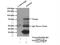 Inositol Polyphosphate-5-Phosphatase J antibody, 21417-1-AP, Proteintech Group, Immunoprecipitation image 