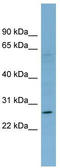 Killer Cell Lectin Like Receptor F1 antibody, TA342016, Origene, Western Blot image 