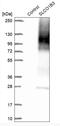 Solute Carrier Organic Anion Transporter Family Member 1B3 antibody, NBP1-80980, Novus Biologicals, Western Blot image 