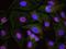 UPF1 RNA Helicase And ATPase antibody, NBP1-05967, Novus Biologicals, Proximity Ligation Assay image 