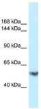 EPH Receptor A1 antibody, TA343156, Origene, Western Blot image 