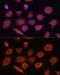 DExD/H-Box Helicase 58 antibody, GTX54000, GeneTex, Immunofluorescence image 