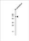 UDP Glycosyltransferase 8 antibody, PA5-48251, Invitrogen Antibodies, Western Blot image 