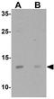 Chromosome 9 Open Reading Frame 116 antibody, GTX32057, GeneTex, Western Blot image 