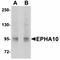 EPH Receptor A10 antibody, orb75233, Biorbyt, Western Blot image 
