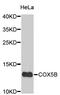 Cytochrome C Oxidase Subunit 5B antibody, STJ26480, St John