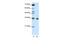 Heterogeneous Nuclear Ribonucleoprotein A1 Like 2 antibody, 29-245, ProSci, Western Blot image 