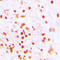 ERCC Excision Repair 6, Chromatin Remodeling Factor antibody, LS-C356022, Lifespan Biosciences, Immunohistochemistry paraffin image 