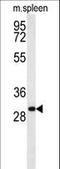 Receptor Transporter Protein 1 antibody, LS-C162806, Lifespan Biosciences, Western Blot image 