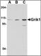 Glutamate Ionotropic Receptor Kainate Type Subunit 1 antibody, orb88374, Biorbyt, Western Blot image 