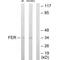 FER Tyrosine Kinase antibody, PA5-49788, Invitrogen Antibodies, Western Blot image 
