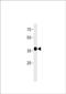 Matrix AAA Peptidase Interacting Protein 1 antibody, PA5-49318, Invitrogen Antibodies, Western Blot image 