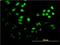 Forkhead box protein F2 antibody, H00002295-M04, Novus Biologicals, Immunocytochemistry image 