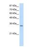 Small Nuclear Ribonucleoprotein Polypeptide A antibody, NBP1-80452, Novus Biologicals, Western Blot image 