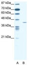 Forkhead Box L2 antibody, TA333692, Origene, Western Blot image 