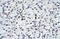 Zinc finger protein GLI2 antibody, ARP31885_T100, Aviva Systems Biology, Immunohistochemistry paraffin image 