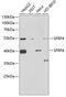 Secreted frizzled-related protein 4 antibody, GTX33493, GeneTex, Western Blot image 