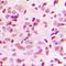 p65 antibody, LS-C358296, Lifespan Biosciences, Immunohistochemistry paraffin image 