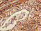 Chromosome 1 Open Reading Frame 105 antibody, LS-C396505, Lifespan Biosciences, Immunohistochemistry paraffin image 