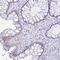 Chromosome 19 Open Reading Frame 73 antibody, NBP2-32367, Novus Biologicals, Immunohistochemistry paraffin image 