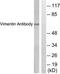 Vimentin antibody, TA312104, Origene, Western Blot image 