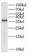 Exostosin Like Glycosyltransferase 2 antibody, FNab02911, FineTest, Western Blot image 