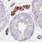 Zinc Finger Protein 878 antibody, HPA052735, Atlas Antibodies, Immunohistochemistry paraffin image 