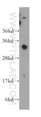 Pyrophosphatase (Inorganic) 1 antibody, 14985-1-AP, Proteintech Group, Western Blot image 