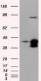 Death Associated Protein Kinase 2 antibody, TA501088S, Origene, Western Blot image 
