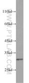 Ribosomal Protein S4 Y-Linked 1 antibody, 17296-1-AP, Proteintech Group, Western Blot image 