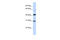Zinc Finger And SCAN Domain Containing 9 antibody, 25-285, ProSci, Enzyme Linked Immunosorbent Assay image 