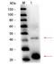 Complement regulator-acquiring surface protein 2 antibody, orb344685, Biorbyt, Western Blot image 
